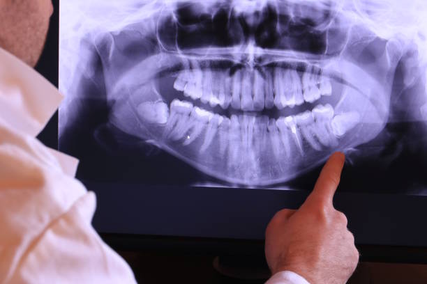 Best Broken Tooth Emergency  in Benson, NC